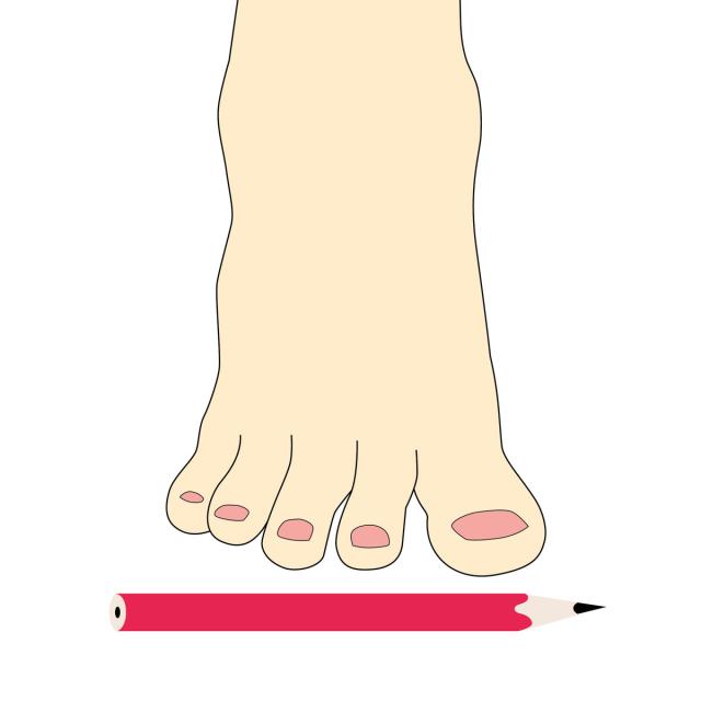 Protektor® - effective shock absorption