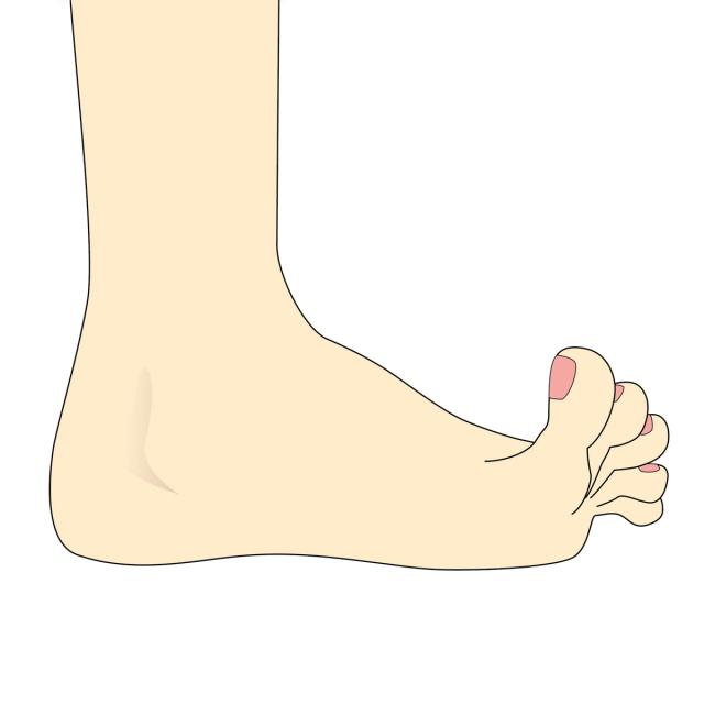 Different outsoles for different feet
