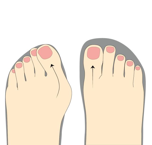 Verdensrekord Guinness Book børste Smuk kvinde Forebyggelse - tænk også sundhed for dine fødder